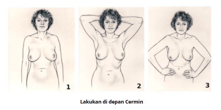 Gambar referensi pemeriksaan payudara di depan cermin